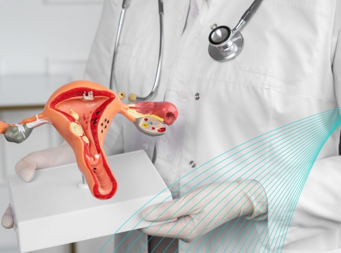 PREVENCIÓN DEL CÁNCER DE CUELLO UTERINO